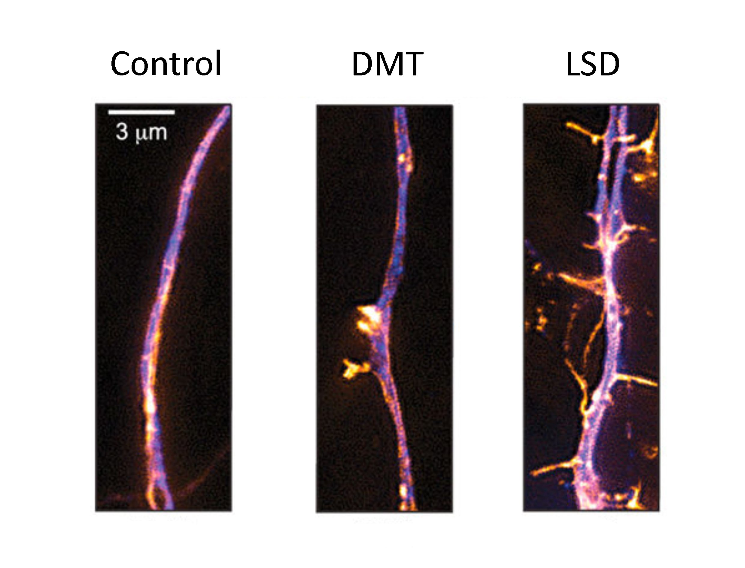 Neurogenesis - design 2 - image only